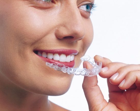 Invisalign Schiene Experte in Köln Kieferorthopäde Invisalign Schiene Experte in Köln Kieferorthopäde